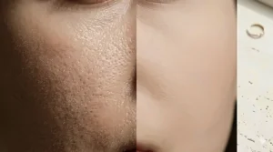 A close-up illustration showing how a mattifying primer fills in pores for a smooth, filtered skin appearance.