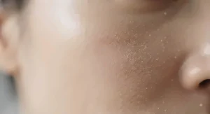 Macro closeup of skin showing the pore-blurring effect of translucent powder for oily skin.